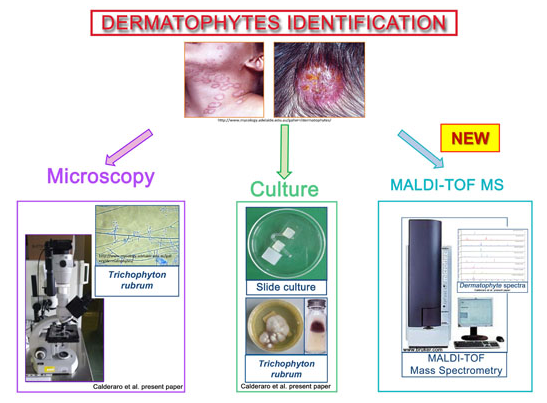 Identifikation von Dermatophyten-Infektionen