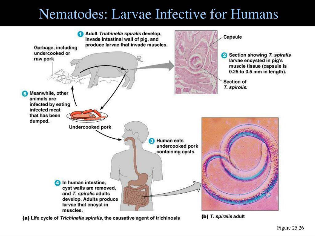 Für den Menschen infektiöse Larven von Nematoden