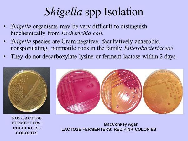 Shigella-Arten